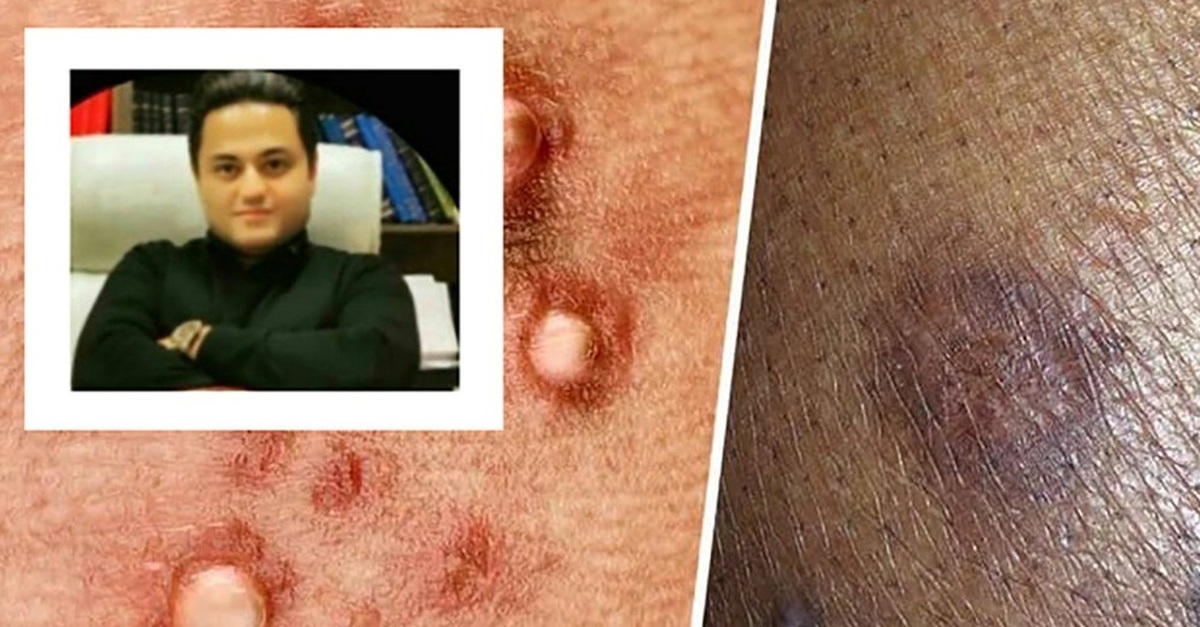 کشف داروی شگفت‌انگیز HPV توسط دانشمند ایرانی